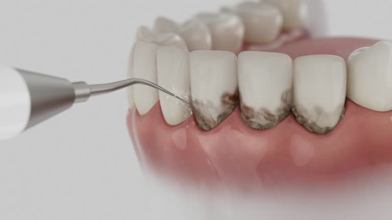 Reliable Teeth Cleaning And Checkup contractor in Lamar County County, MS by Dentist Open Now